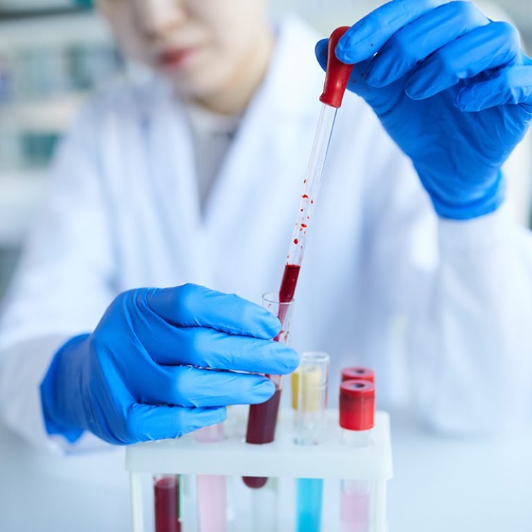 Blood-and-Urine-Culture-Testing