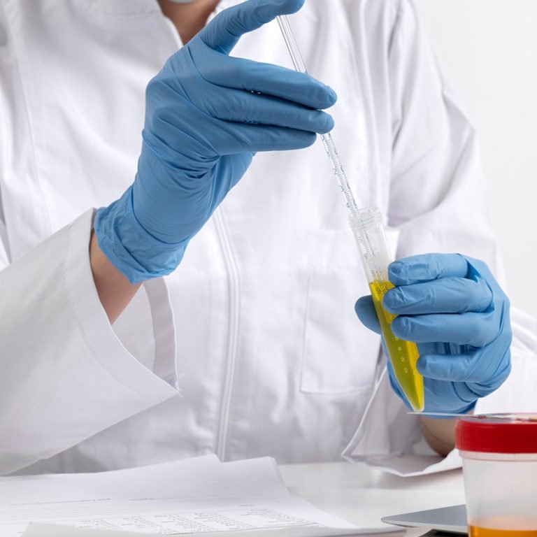 Gonorrhea-Testing